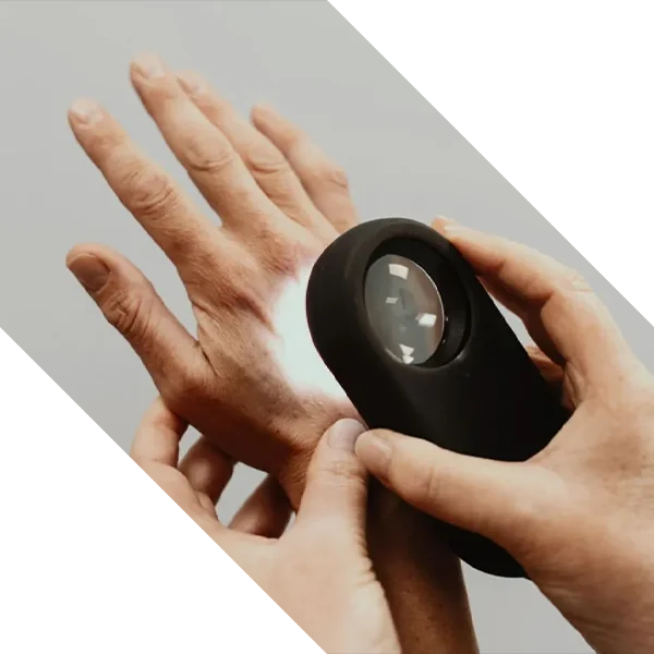 MoleMap, Healthcare, Skin Cancer Detection