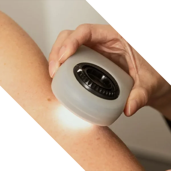 MoleMap additional view